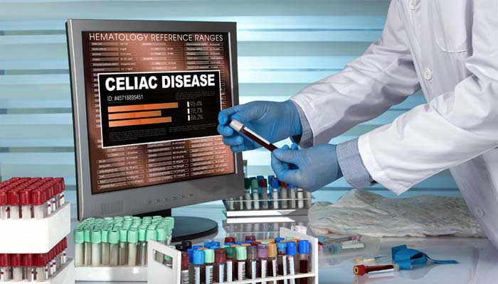Celiachia test