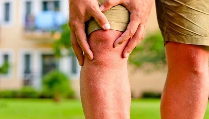 artrite ginocchio