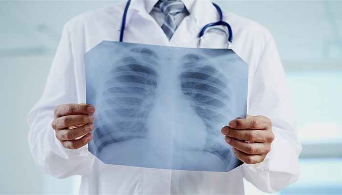 polmoni dottore