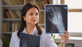 Artrite Radiografia